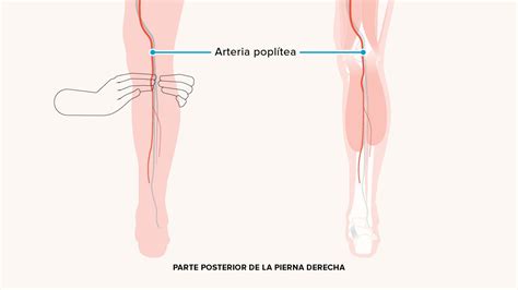 R Ckerstattung Magnet Verformung Dolor Detras De La Rodilla Y