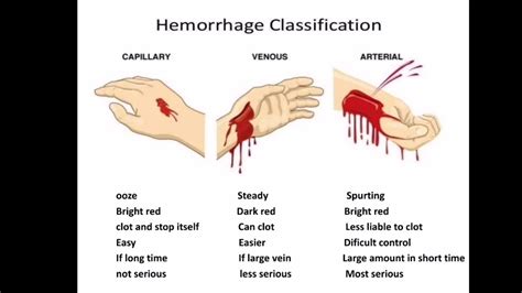 Hemorrhage Youtube