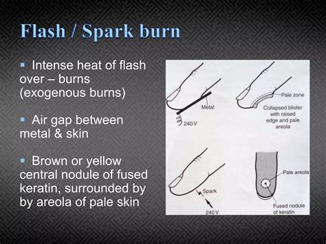 electrical injuries dr ashutosh pptx