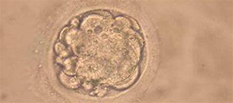 Scientists Grow Human Embryo Model Without Sperm Or Egg The Daily Caller