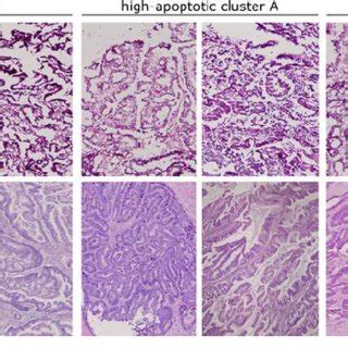 Representative Photomicrographs Of HE Stained Tumor Tissues Frozen