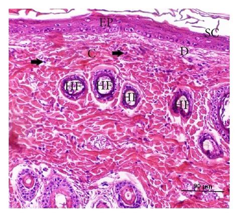 Histological Sections From The Wound Area Stained With Download