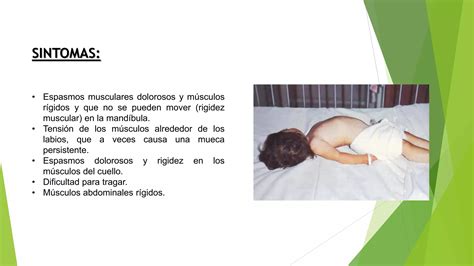 Tetano Neonatal Pptx Descarga Gratuita