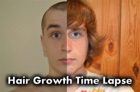 Hair Growth Time Lapse