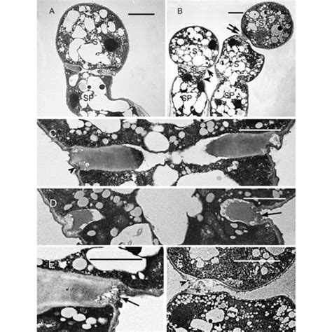 Transmission Electron Micrographs Of Albugo Candida Sporangium