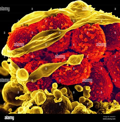 Mrsa Microscope Hi Res Stock Photography And Images Alamy