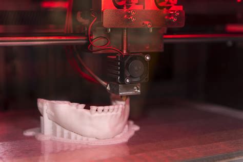 Tecnología De Impresión 3d Aplicado En La Medicina Impresoras 3d Perú Krear 3d