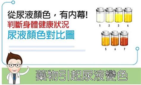 沖水前瞄一眼 尿液顏色能看健康 但這些藥物會讓它變色 健康 中時新聞網