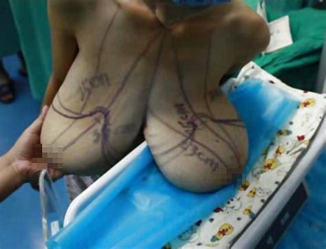 MACROMASTIA Porn Pictures XXX Photos Sex Images 1955448 PICTOA