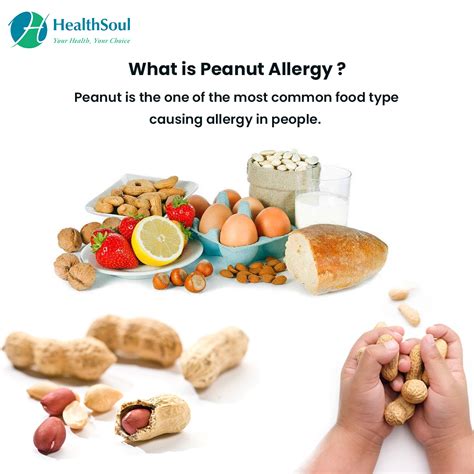 Peanut Allergy Symptoms Causes And Management Healthsoul