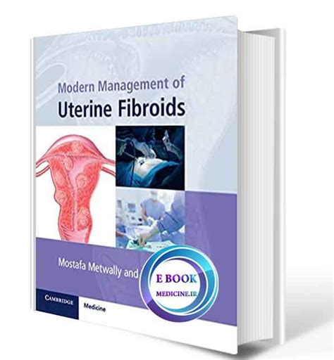 دانلود کتابmodern Management Of Uterine Fibroids2020original Pdf