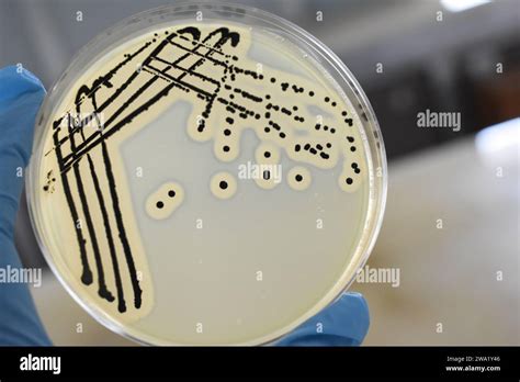 A Quadrant Streak Of The Bacterium Staphylococcus Aureus Cultured Or