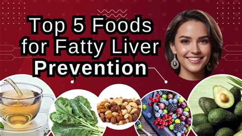 Prioritizing Liver Health Youtube