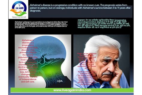 Alzheimers Disease Causes Prognosis Treatment Rehabilitation And