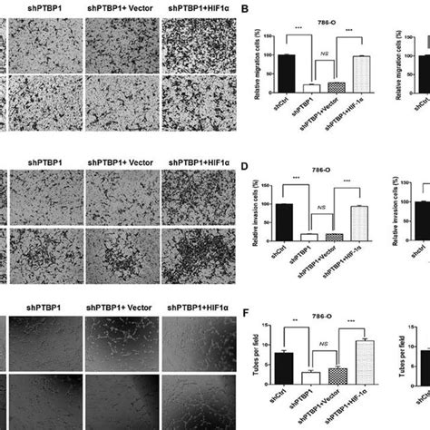 PTBP1 knockdown inhibited the proliferation, migration, invasion and ... 