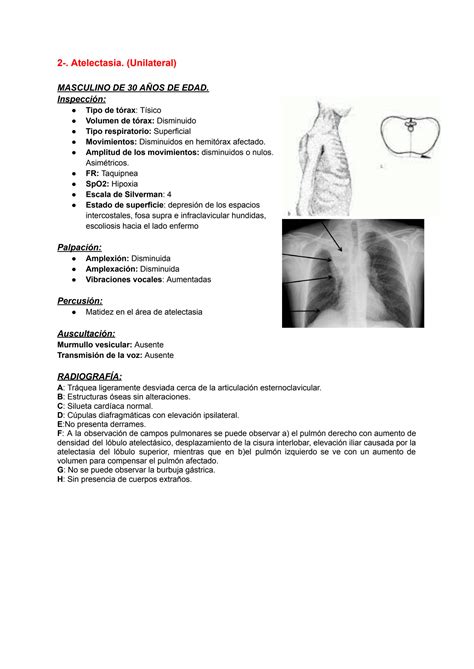 SOLUTION Síndromes pleuropulmonares Studypool