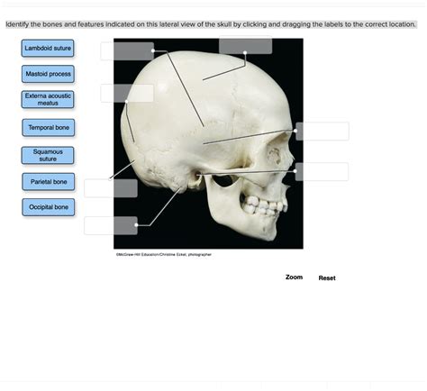 Solved Identify The Bones And Features Indicated On This Chegg