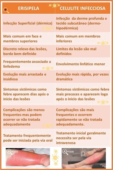 Celulite Infecciosa Tempo De Cura - Erisipela ou Celulite Infecciosa: Conheça A Doença | Dra. Keilla ...