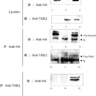 TRAF6 And TAK1 Co Immunoprecipitate With Edaradd A HEK 293T Cells