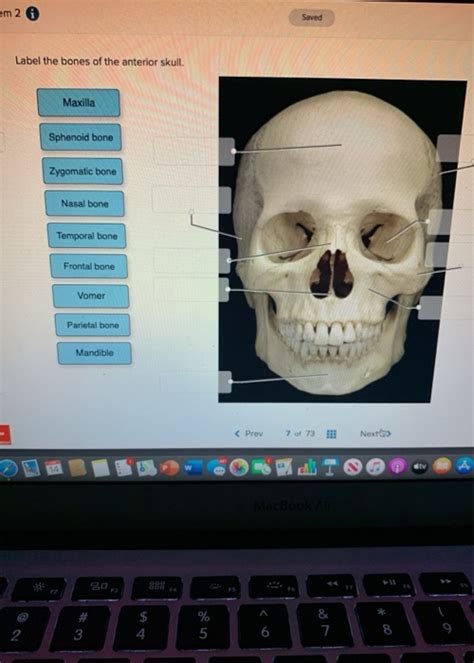 Solved Em 26 Saved Label The Bones Of The Anterior Skull Chegg