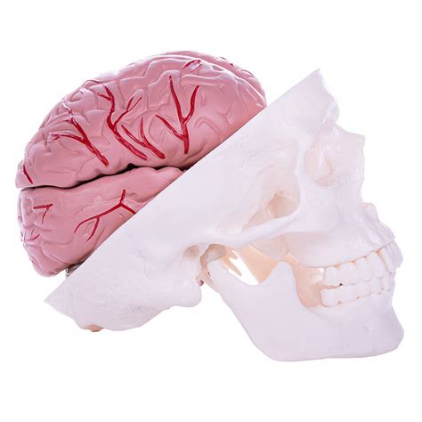 skull brain model winterthur medical plc medical devices