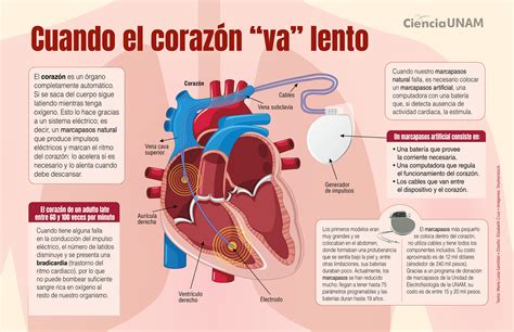 Infografia El Marcapasos Ciencia Unam