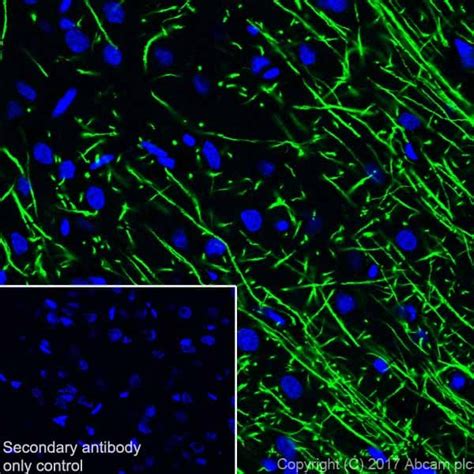 Recombinant Anti Myelin Basic Protein Antibody Epr Bsa And