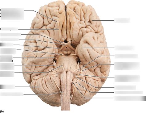 Ventral Brain Cadaver Diagram Quizlet