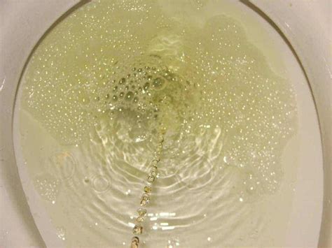 Bubbles in urine during pregnancy