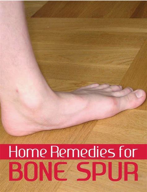 Home Remedies For Bone Spur Veda Remedies Home Remedies Bone Spurs Remedies