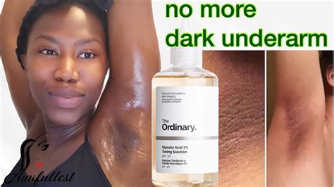 How To Lighten Your Armpit With The Ordinary Glycolic Acid Toning