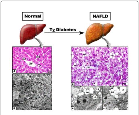 Histology And Transmission Electron Microscopy Of Liver A And B