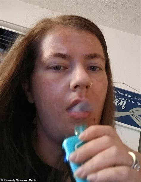 Mega Vaping Addict Hospitalised With Collapsed Lungs And Black Goo