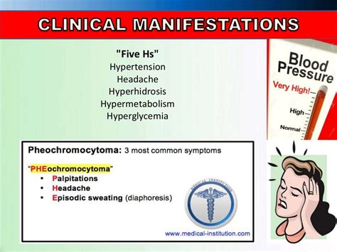 Pheochromocytoma