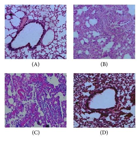 Intranasal Administration Of Anti HMGB1 IgG Suppressed Neutrophilic