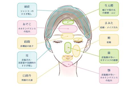 【ニキビマップ付き】ニキビの場所ごとの原因と治し方を徹底解説！ ハダメディア By Bihadadotokyo