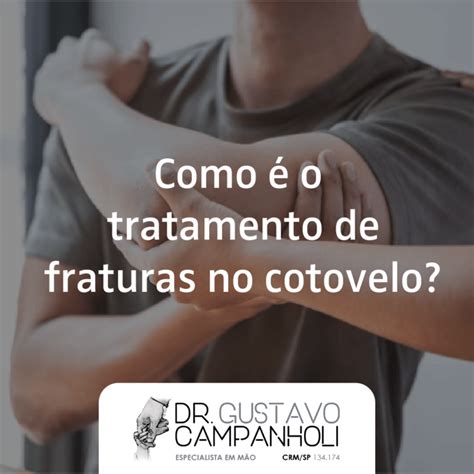 Como O Tratamento De Fraturas No Cotovelo Doutor Gustavo