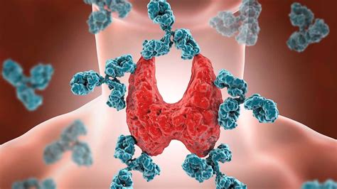 T4 yüksekliği ve düşüklüğü nasıl belli olur 13 başlıkta T4 hormonu