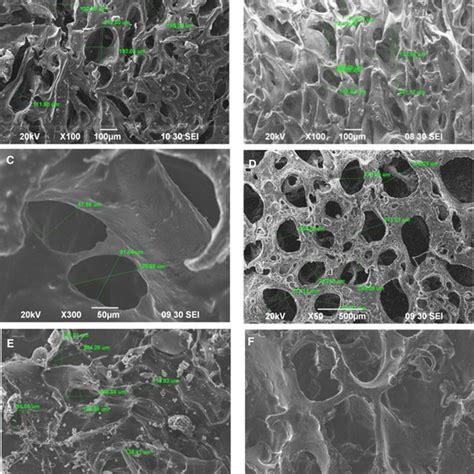 Pdf Fabrication Of Biocompatible Porous Scaffolds Based On Hydroxyapatite Collagen Chitosan