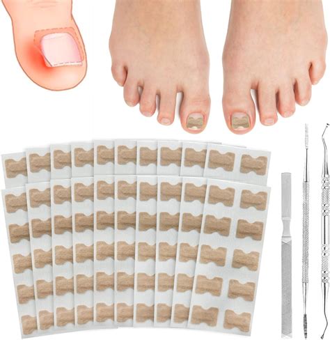 Pcs Toenail Stick Patch With Pcs Ingrowing Toenail Kits Spokki