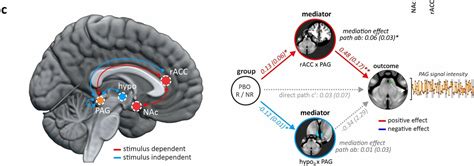 Brain networks of placebo analgesia | Neuroscience Community