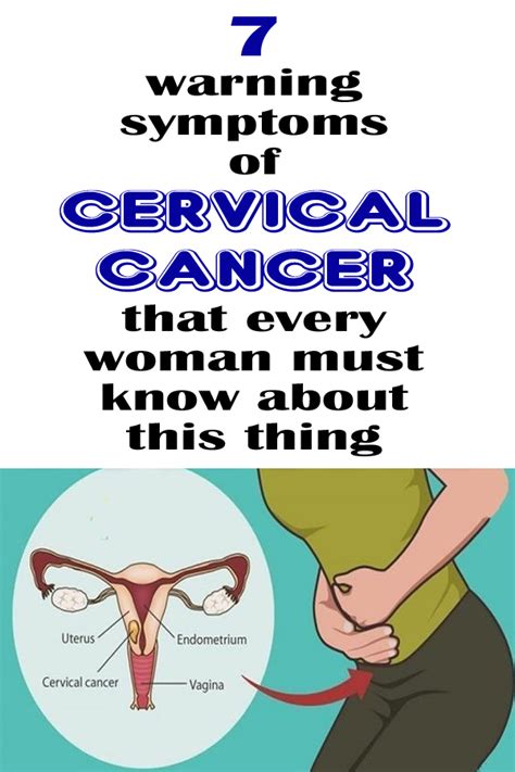 Cervical Cancer Symptoms Warning Signs