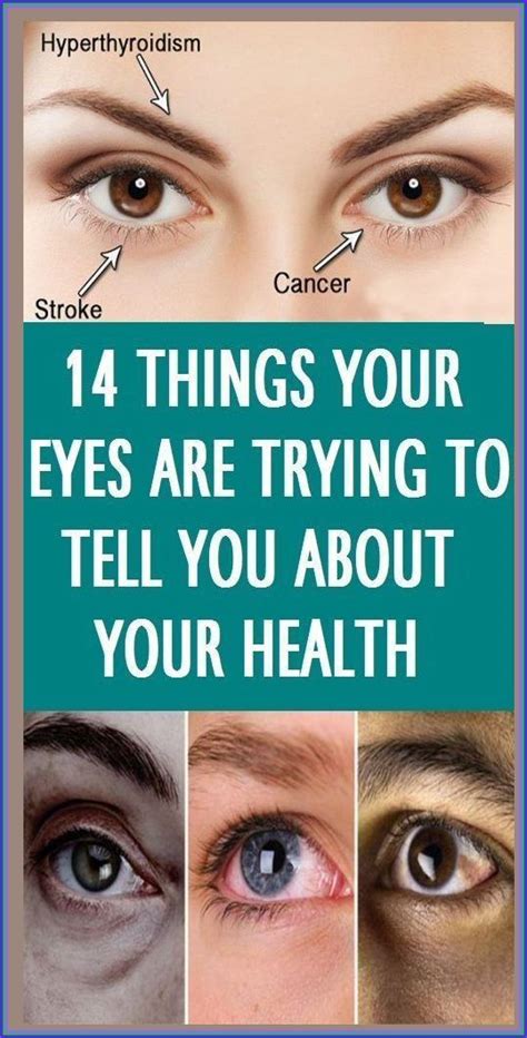 14 Things Your Eyes Can Reveal About Your Health Artofit