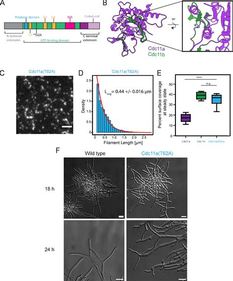 Figure 7 From A Gene Duplication Of A Septin Reveals A Developmentally