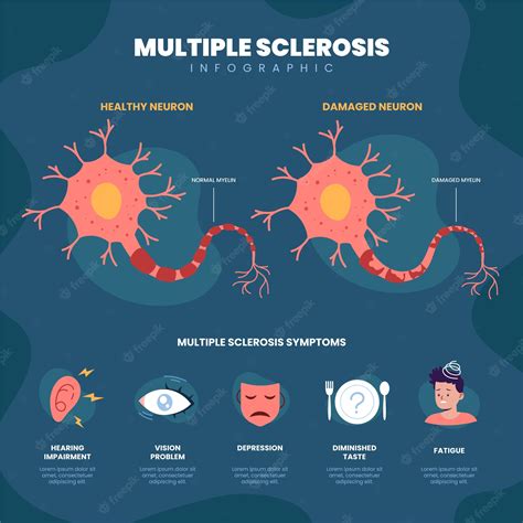 Infografía De Esclerosis Múltiple De Diseño Plano Dibujado A Mano