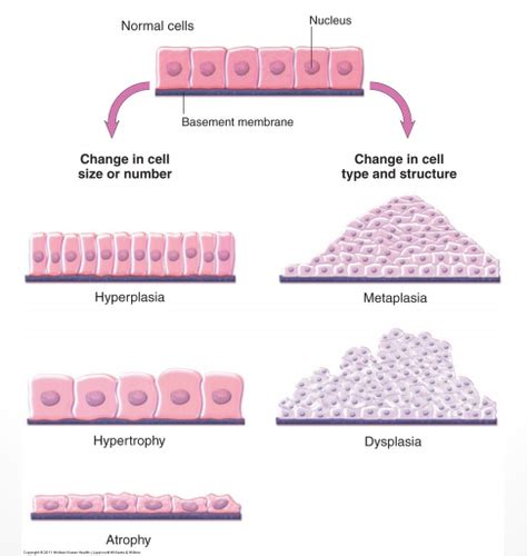 Cellular Adaptations Flashcards Quizlet