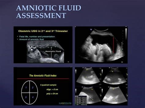 Basic Obstetric Ultrasound Training