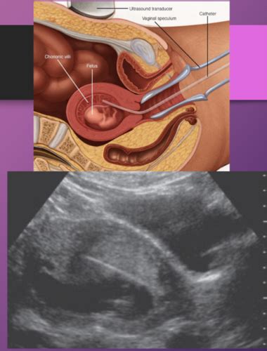 Ch 55 Prenatal Diagnosis Of Congenital Anomalies Flashcards Quizlet