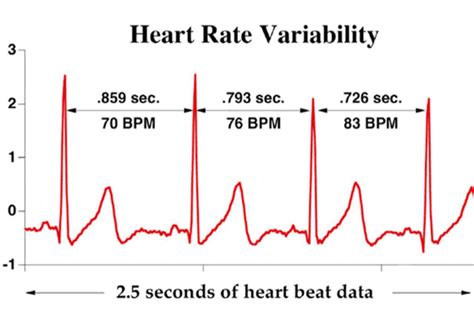 ¿que Es La Variabilidad De La Frecuencia Cardiáca Hrv Trimexico