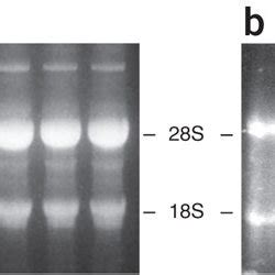 Examples of RNA gels.(a) RNA gel electrophoresis. Six samples, 20 g per ...